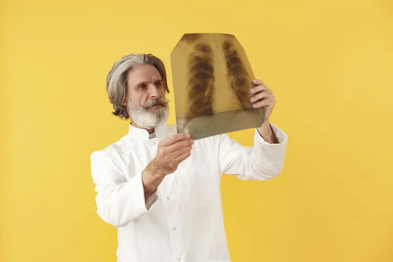 Senior male doctor holding and examining a chest x-ray, posing against a bright yellow studio background.