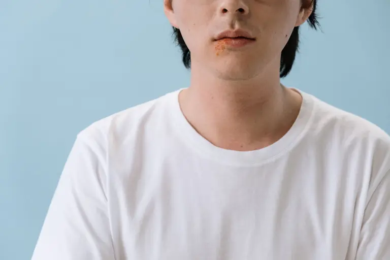 Close-up image of an adult male with a facial skin condition against a blue background.